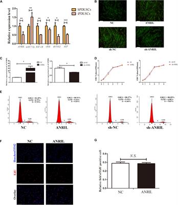 Upregulating the Expression of LncRNA ANRIL Promotes Osteogenesis via the miR-7-5p/IGF-1R Axis in the Inflamed Periodontal Ligament Stem Cells